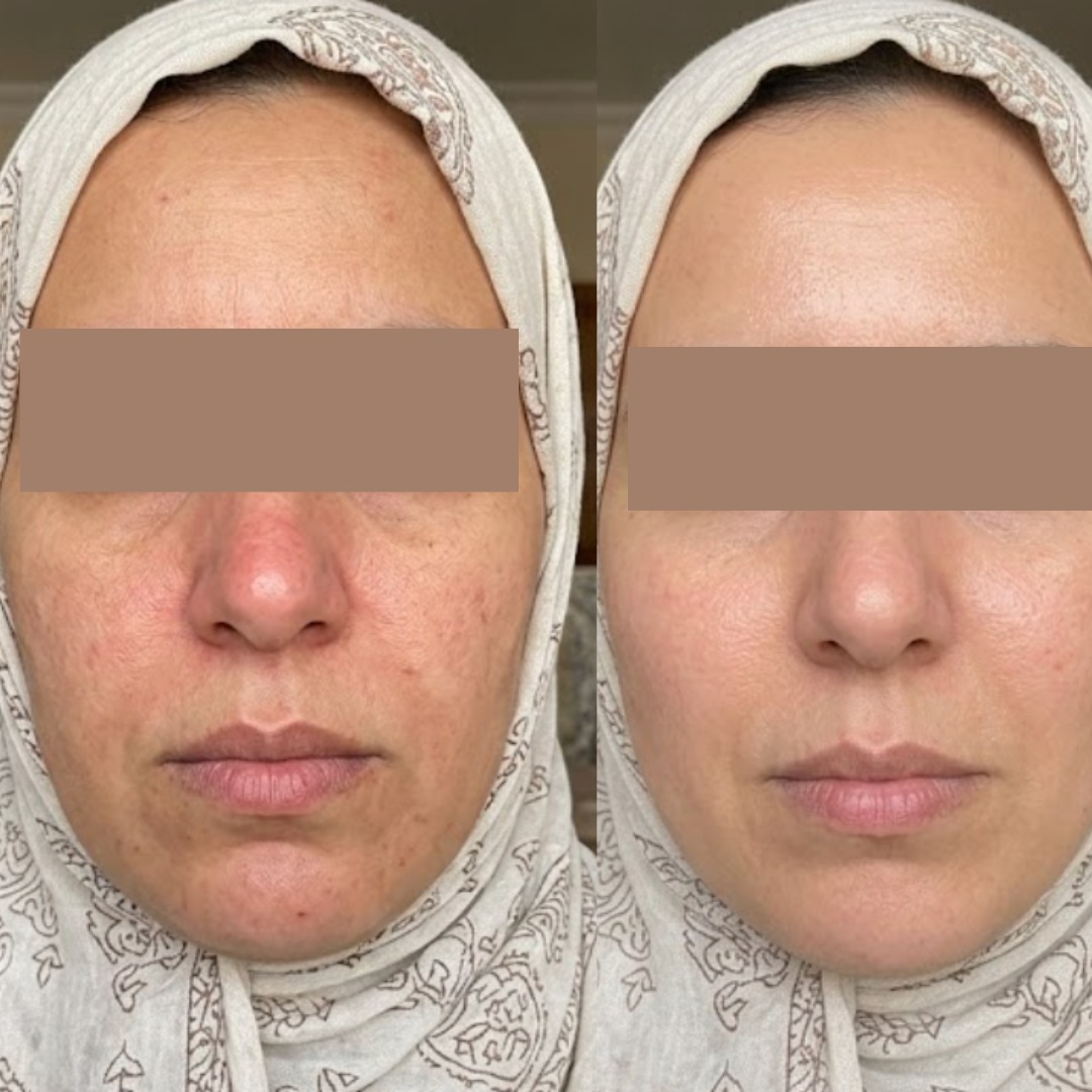نتيجة فاطمة الزهراء من بلباو