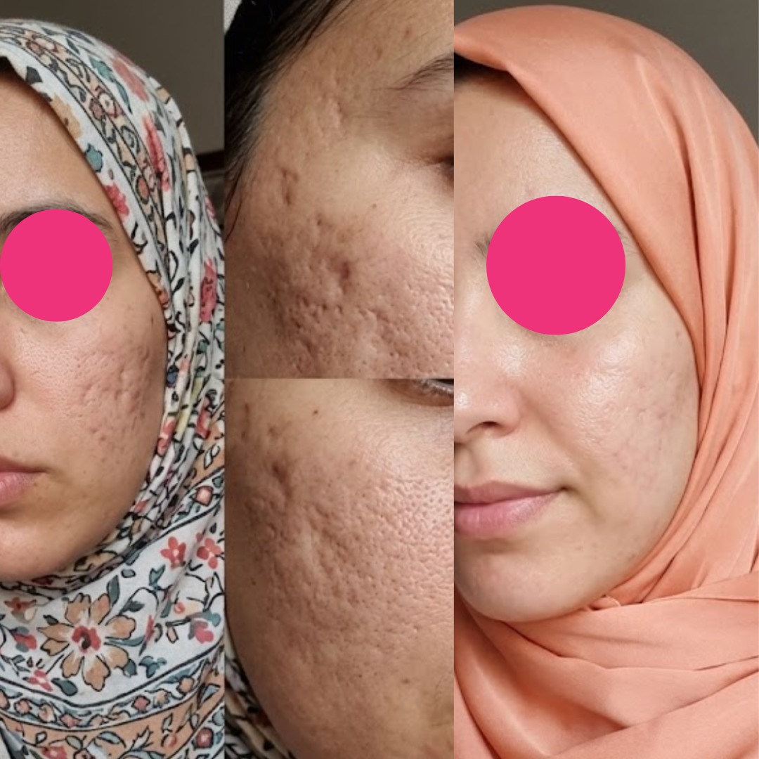 نتيجة جميلة من جيرونا
